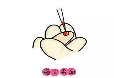 儿童绿巨人黄色视频下载微量元素的检测项目有哪些 儿童绿巨人黄色视频下载微量元素的检测项目有哪些